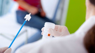 Δωρεάν προληπτικές εξετάσεις Τεστ ΠΑΠ και HPV DNA τεστ